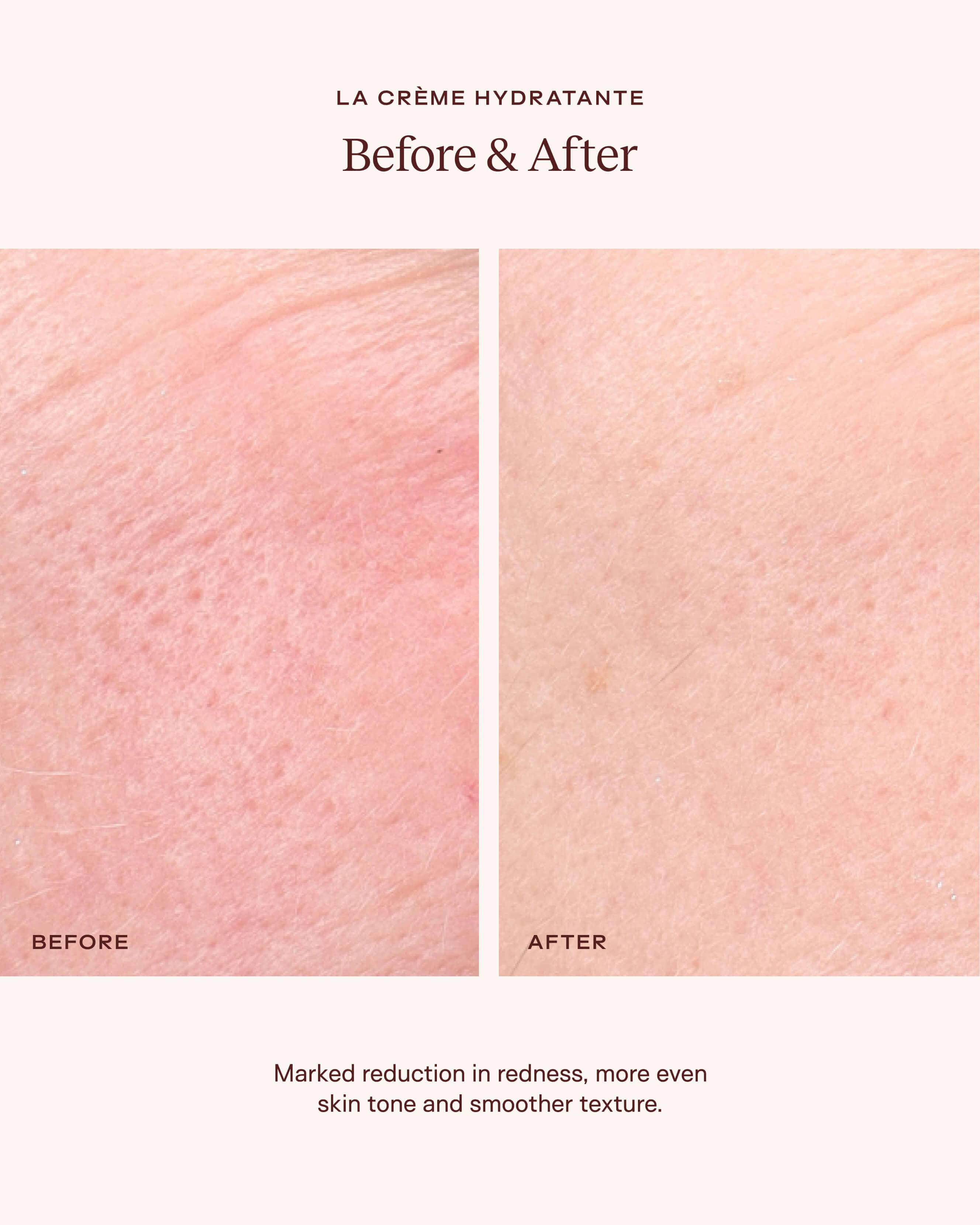 La Crème Hydratante: Beta-Glucan Antioxidant-Rich Mushroom Moisturizer