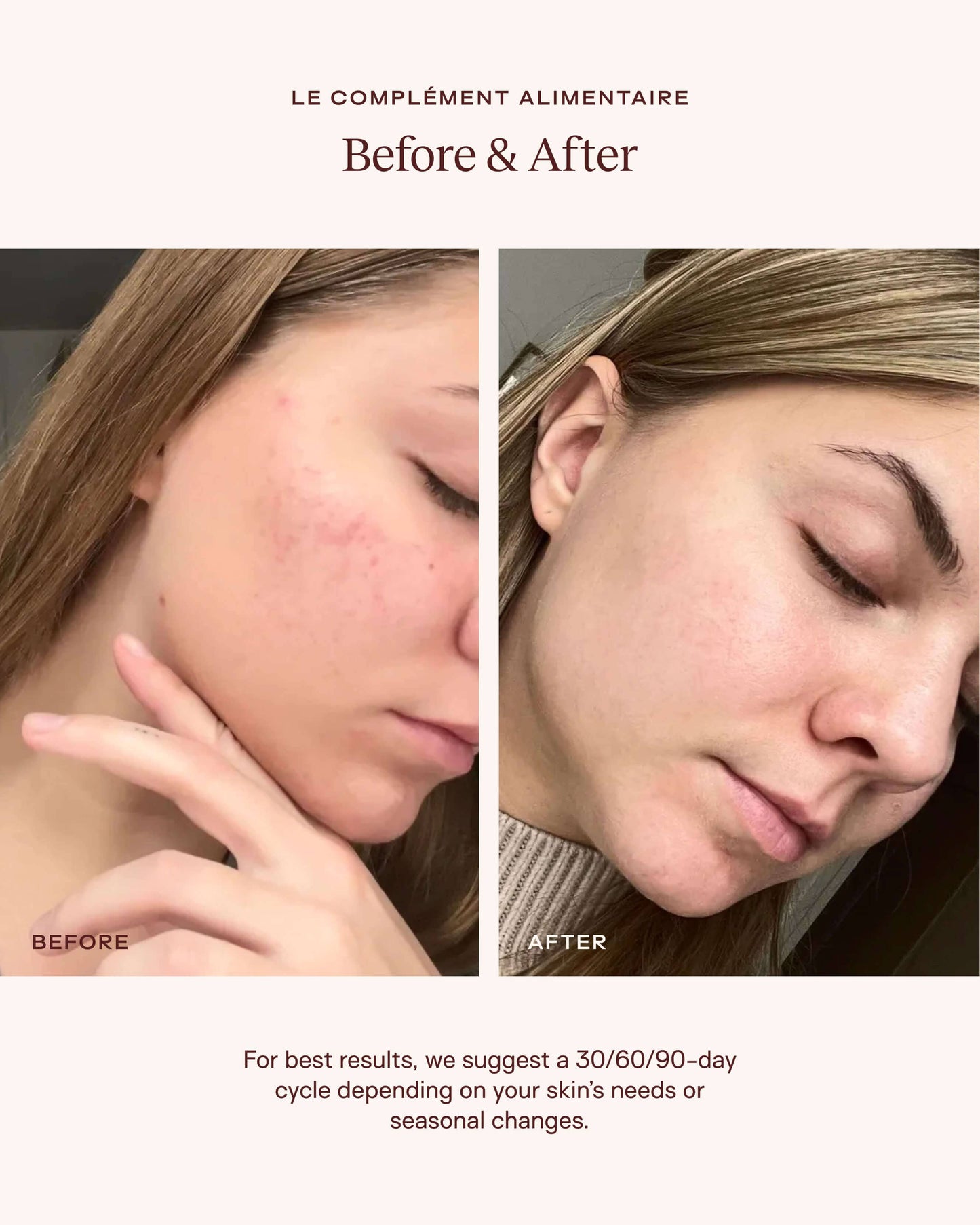 Le Complément Alimentaire: Plumping Hydration Support with Antioxidants