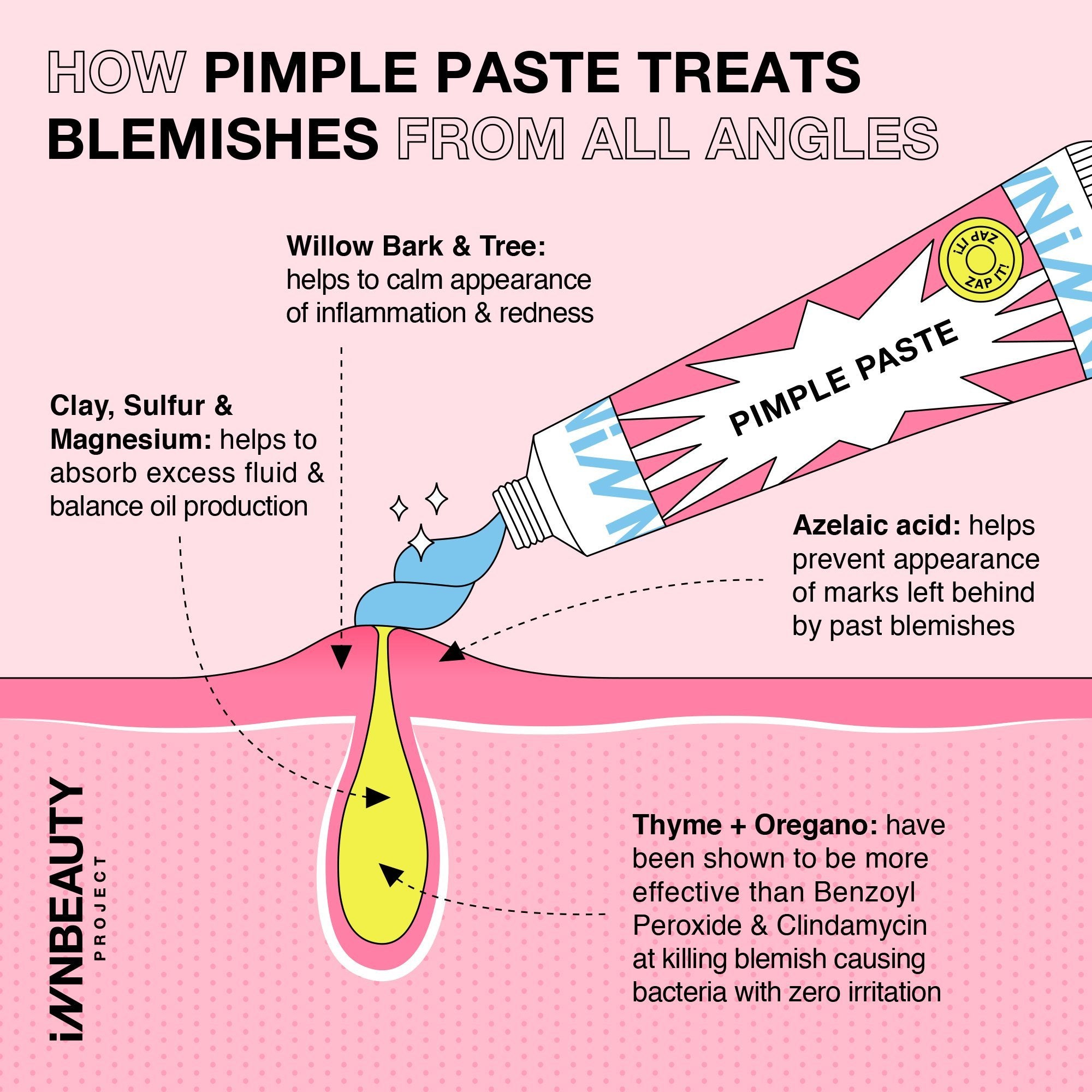 Pimple Paste Overnight Drying Paste