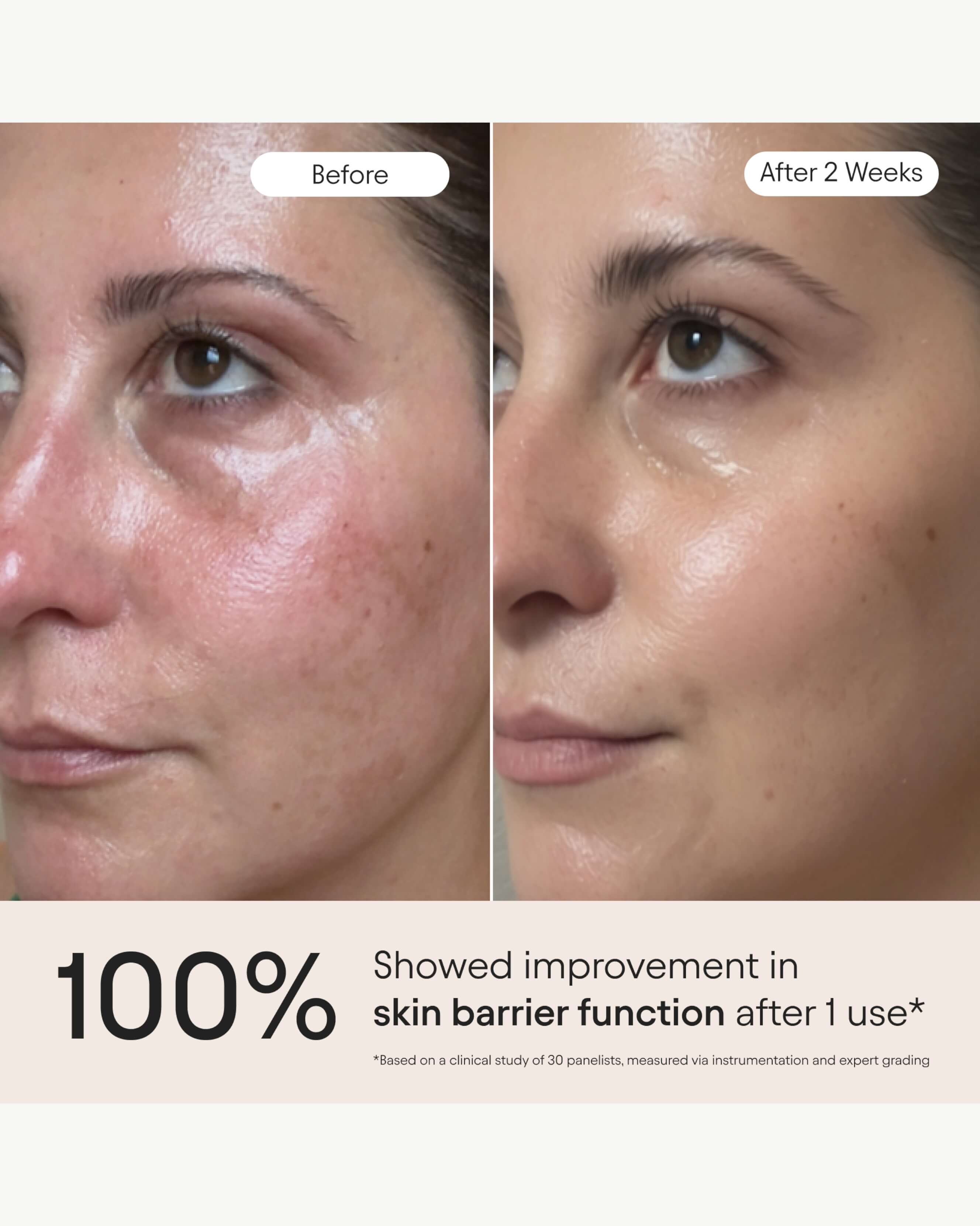 3-in-1 Barrier Repair Serum
