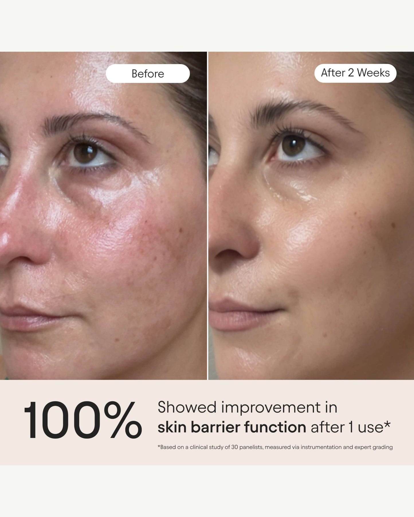 3-in-1 Barrier Repair Serum