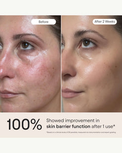 3-in-1 Barrier Repair Serum