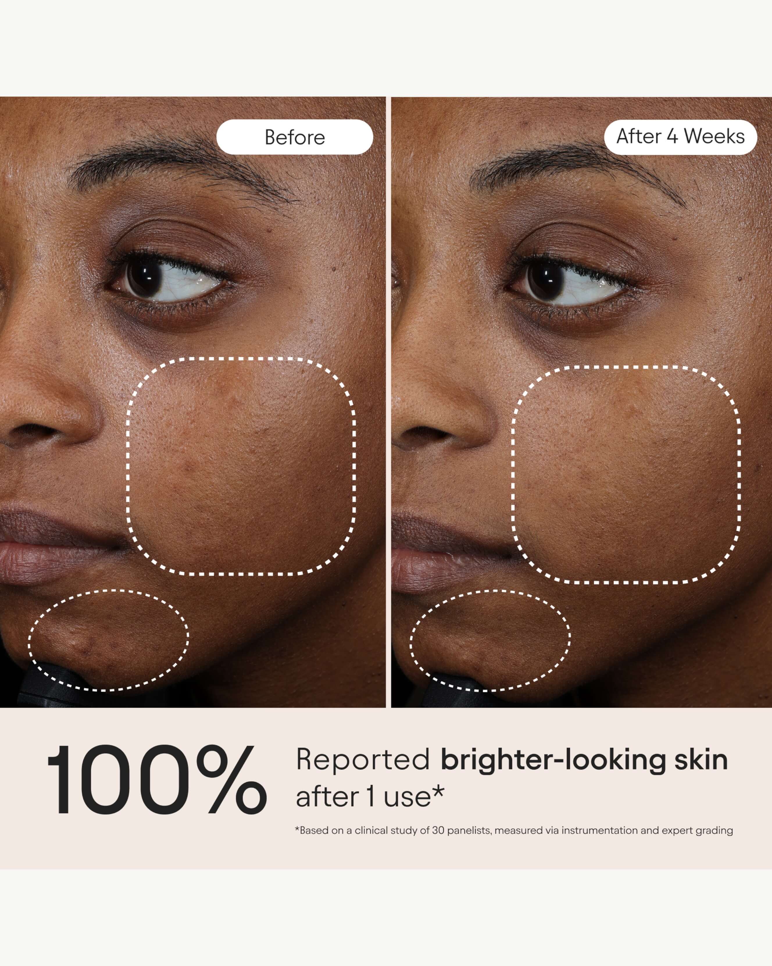 3-in-1 Barrier Repair Serum