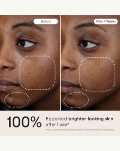 3-in-1 Barrier Repair Serum