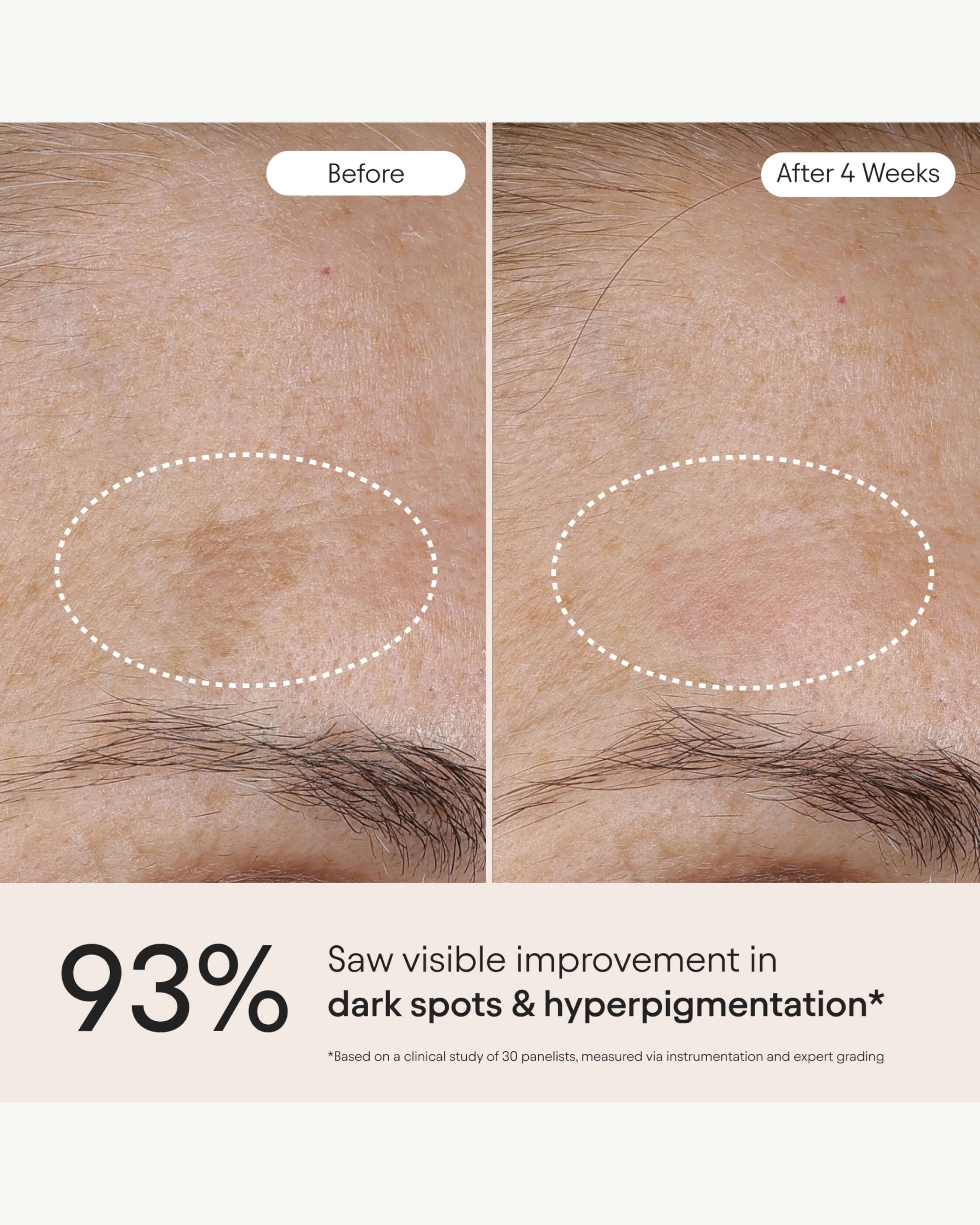 3-in-1 Barrier Repair Serum