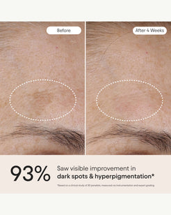 3-in-1 Barrier Repair Serum