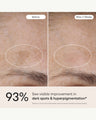 3-in-1 Barrier Repair Serum