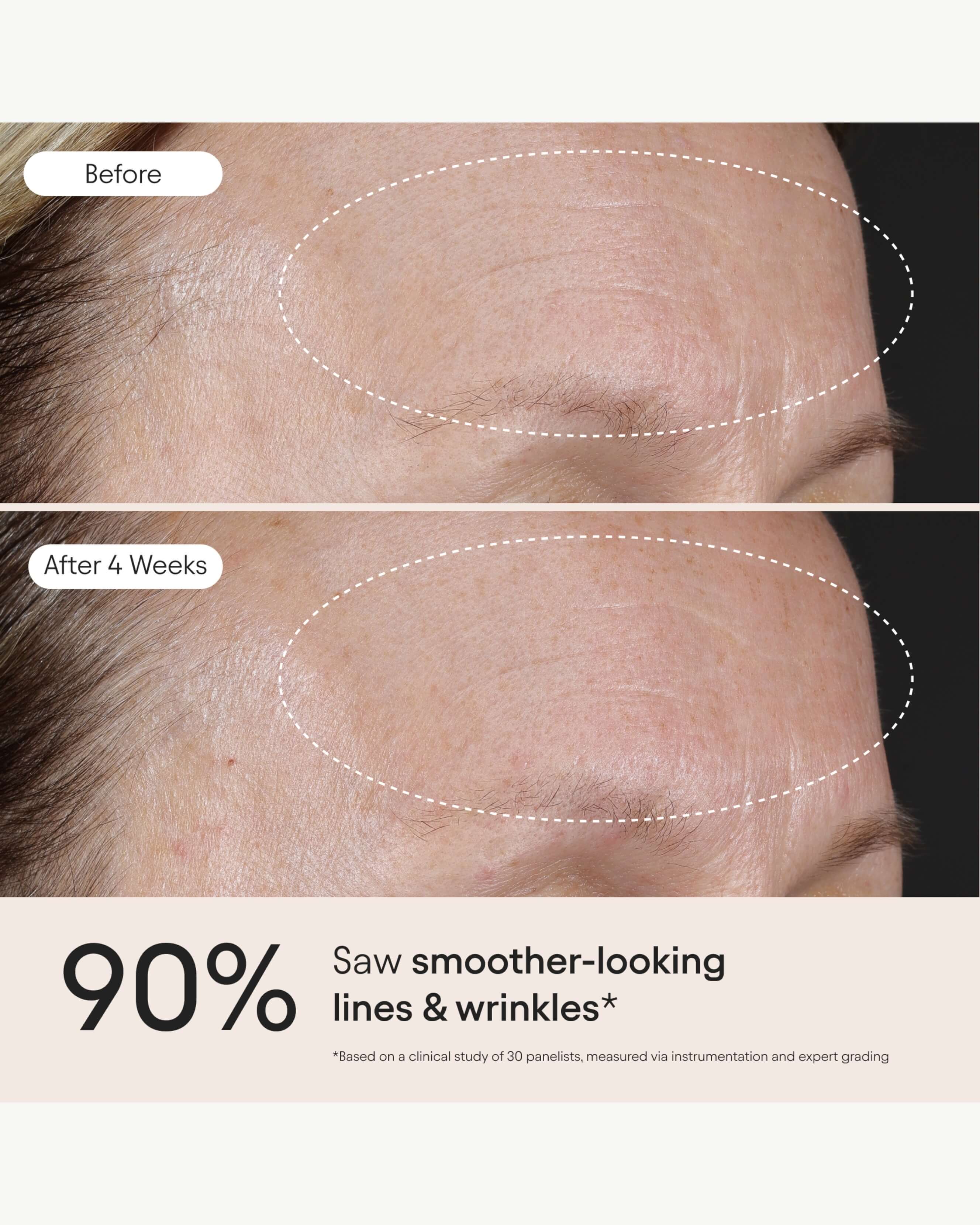 3-in-1 Barrier Repair Serum