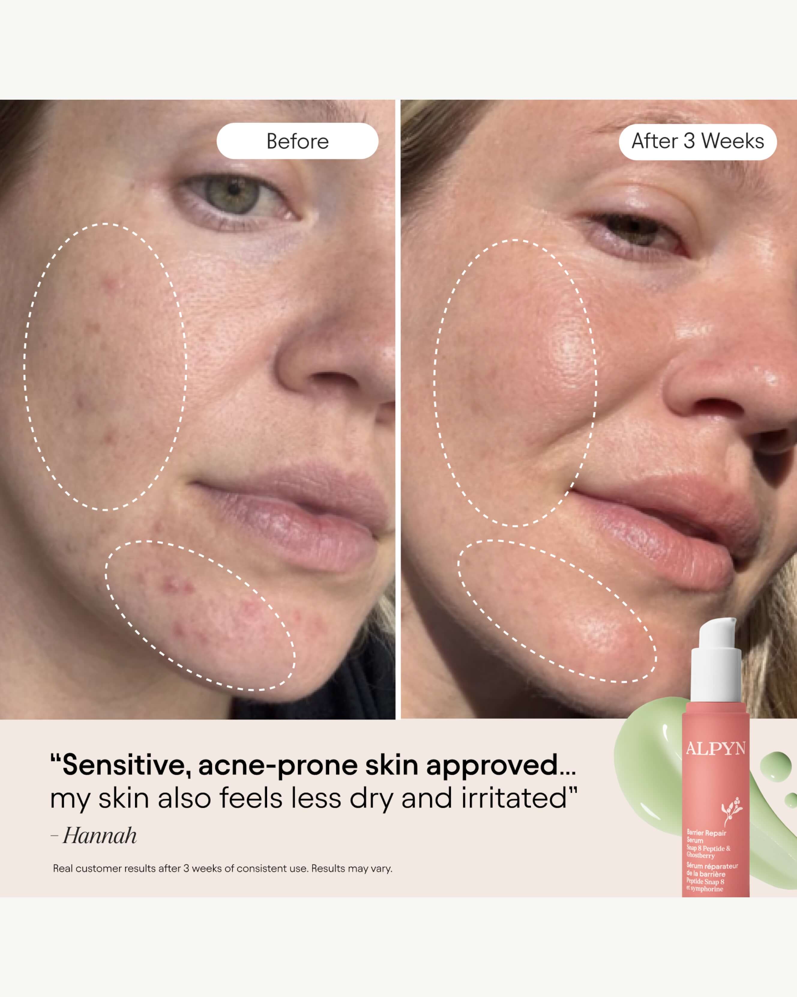 3-in-1 Barrier Repair Serum