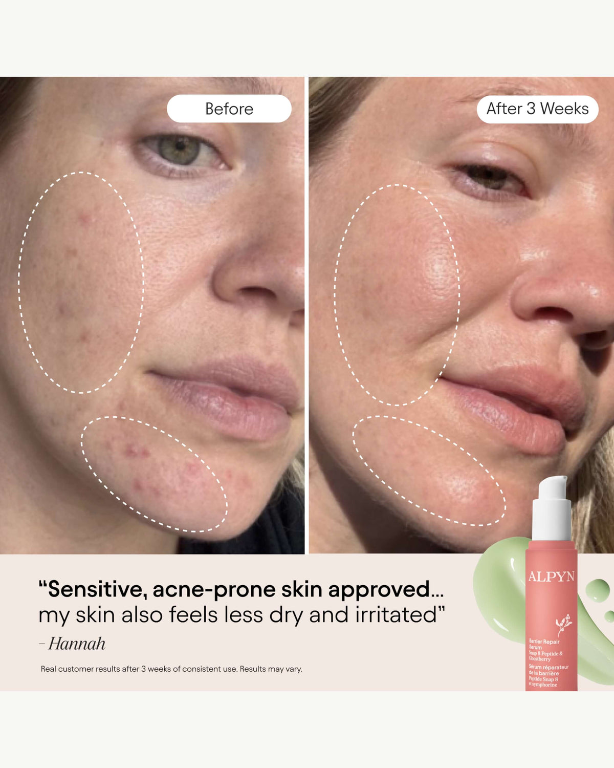 3-in-1 Barrier Repair Serum