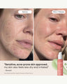 3-in-1 Barrier Repair Serum