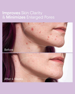Pore Perfecting Liquid with 2% BHA + Borage