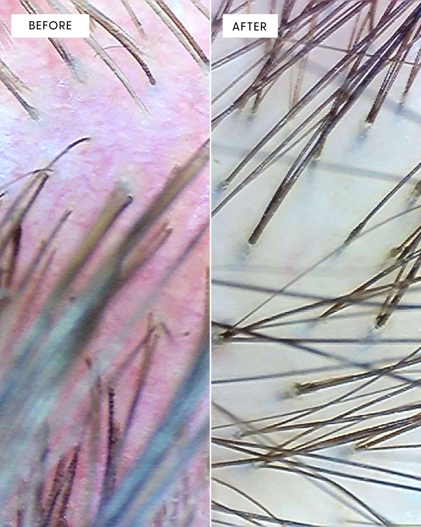 Calm It Down Scalp Repair