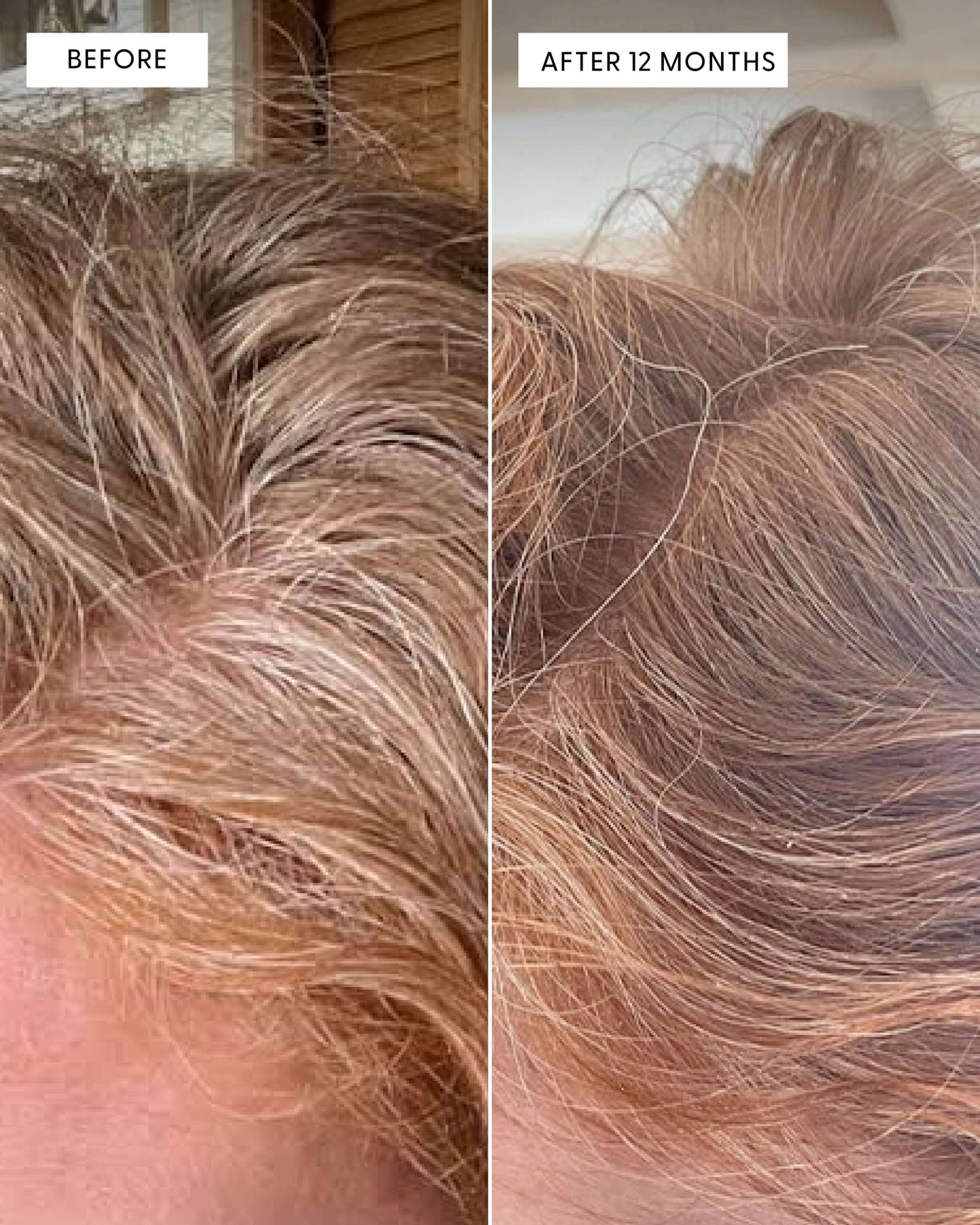 Not Today, Grey Supplement