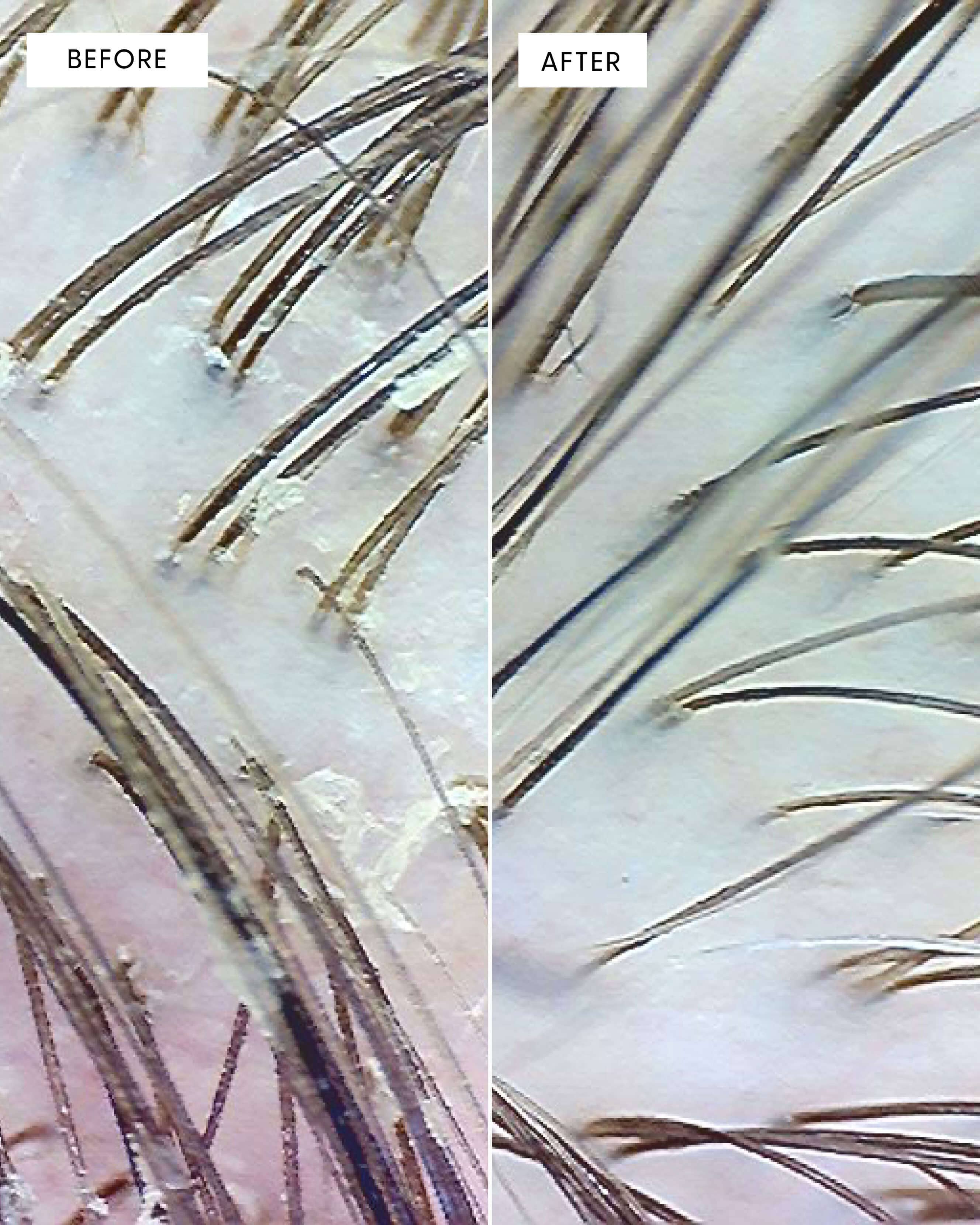 Scrub Scalp Exfoliant