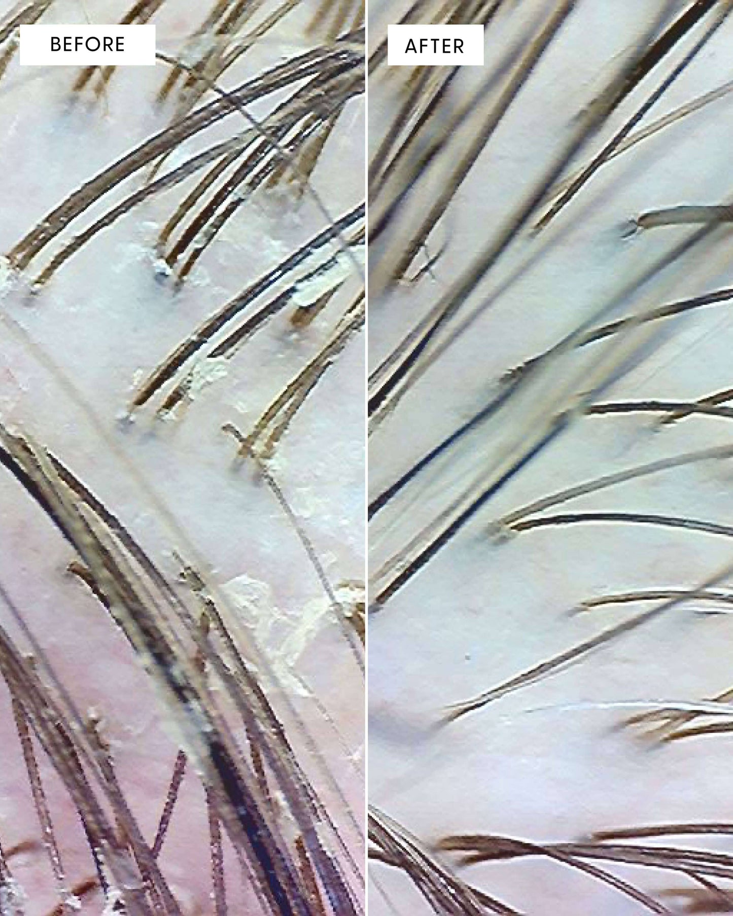 Arey Scalp Renewal Duo