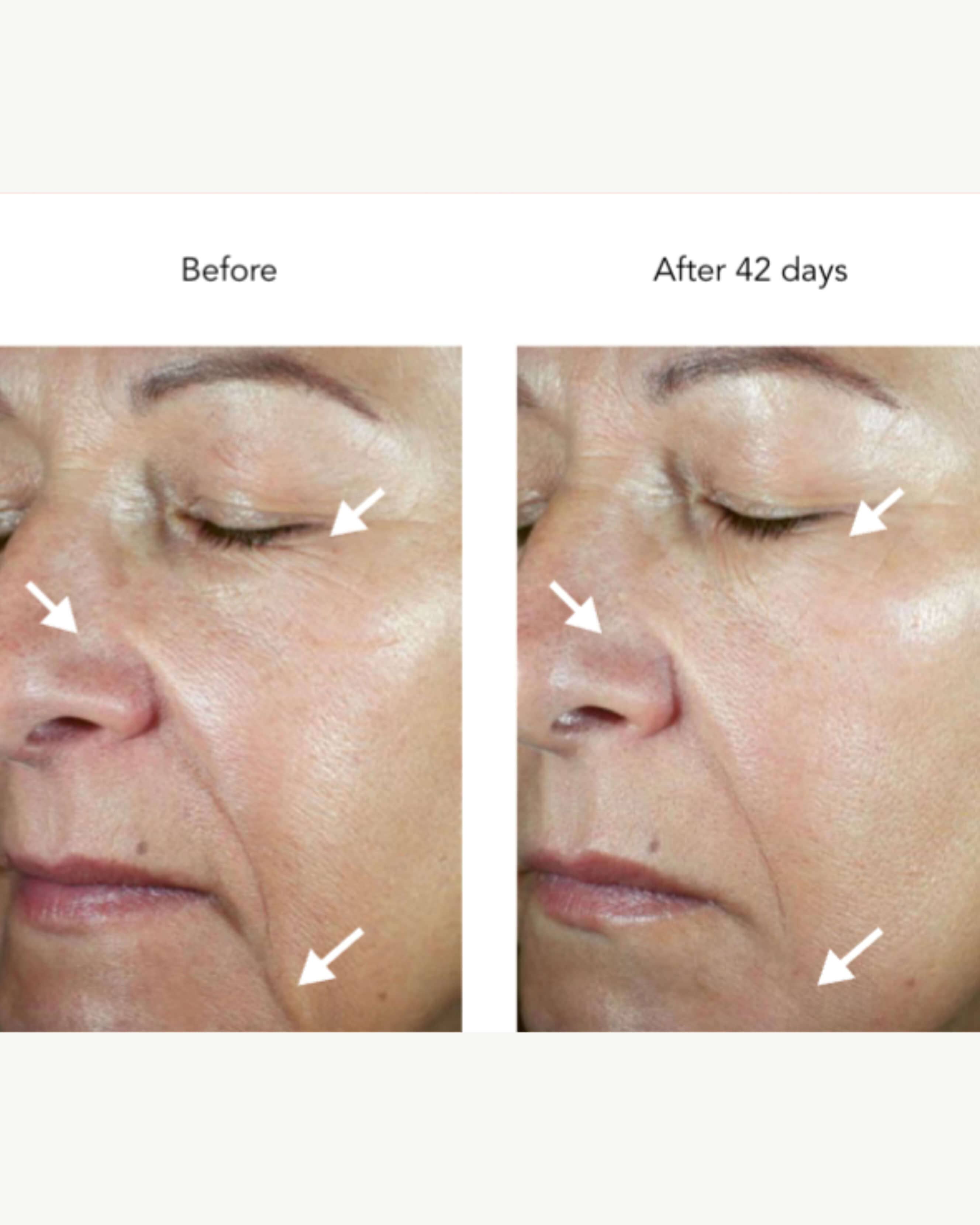 DNA-42 Clinicalift Serum – Credo