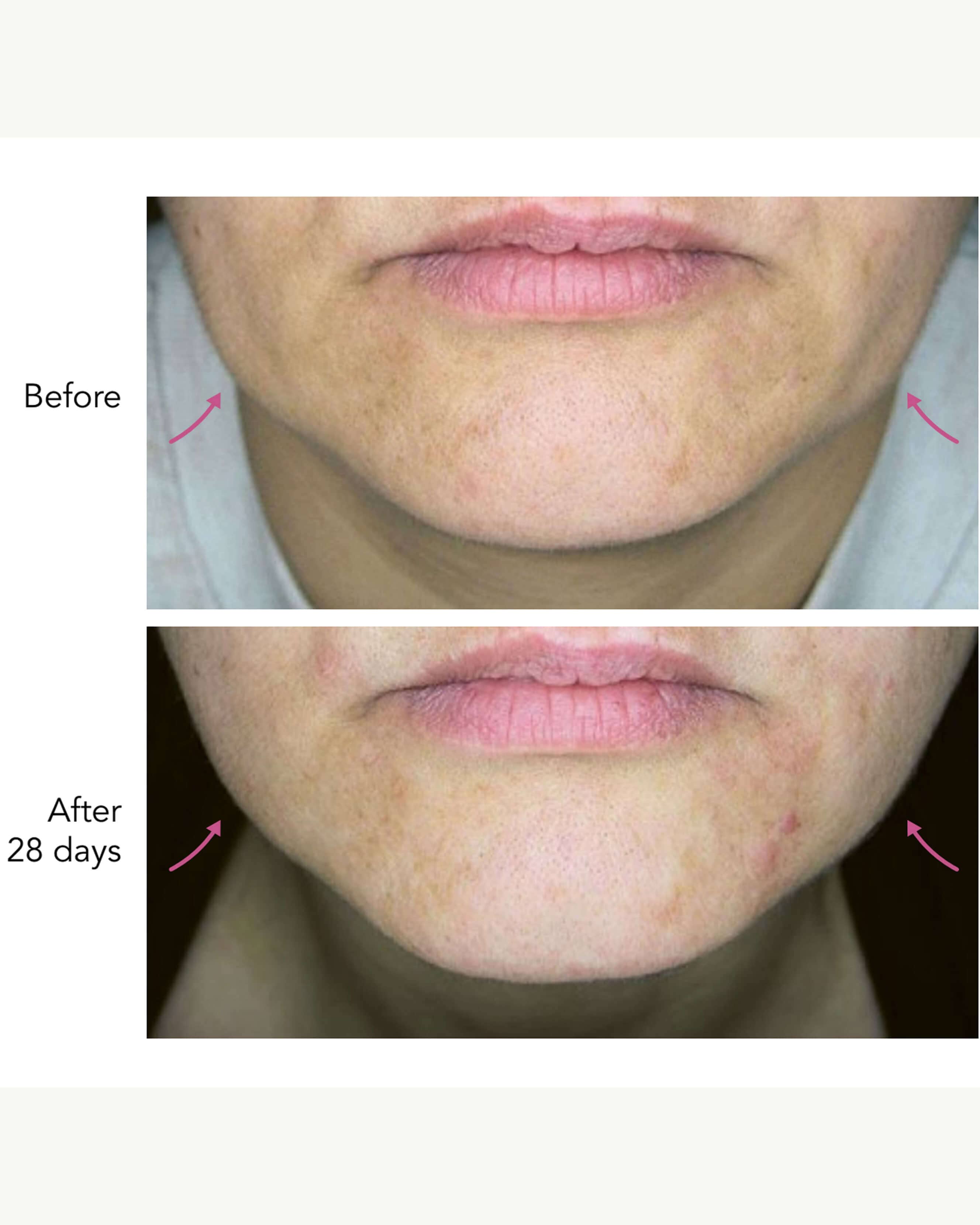 DNA-42 Clinicalift Serum – Credo