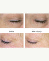 DNA-42 Clinicalift Serum