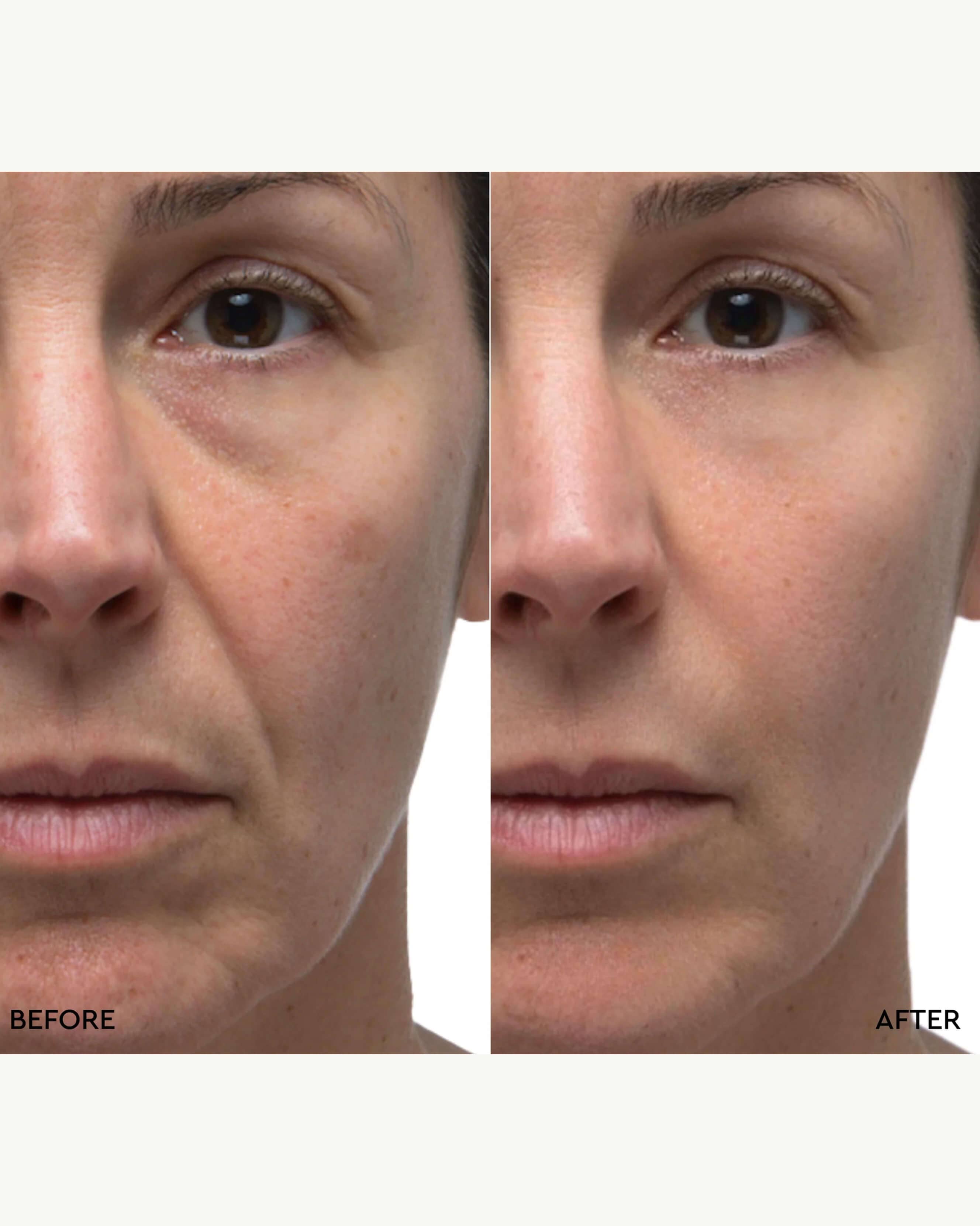 Retinol Rescue Overnight Cream