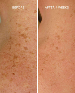 Glycolic + Bakuchiol Smoothing Body Treatment