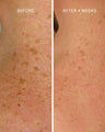 Glycolic + Bakuchiol Smoothing Body Treatment