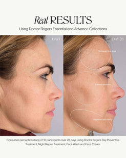 Night Repair Treatment - Original