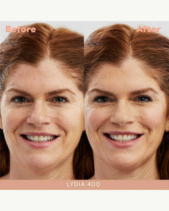 Lydia 400 (light with red undertones)