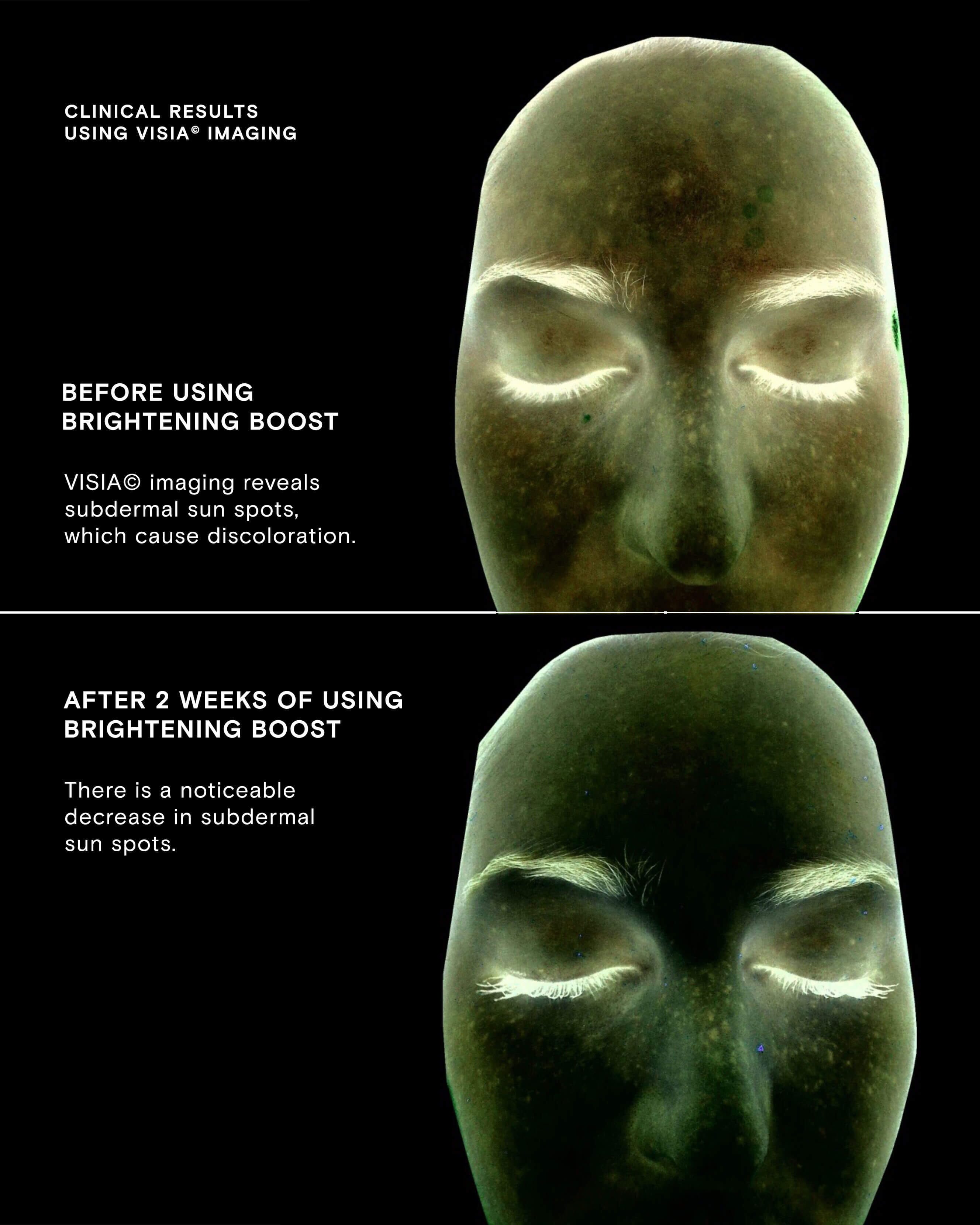 Brightening Boost Vitamin C Power Serum