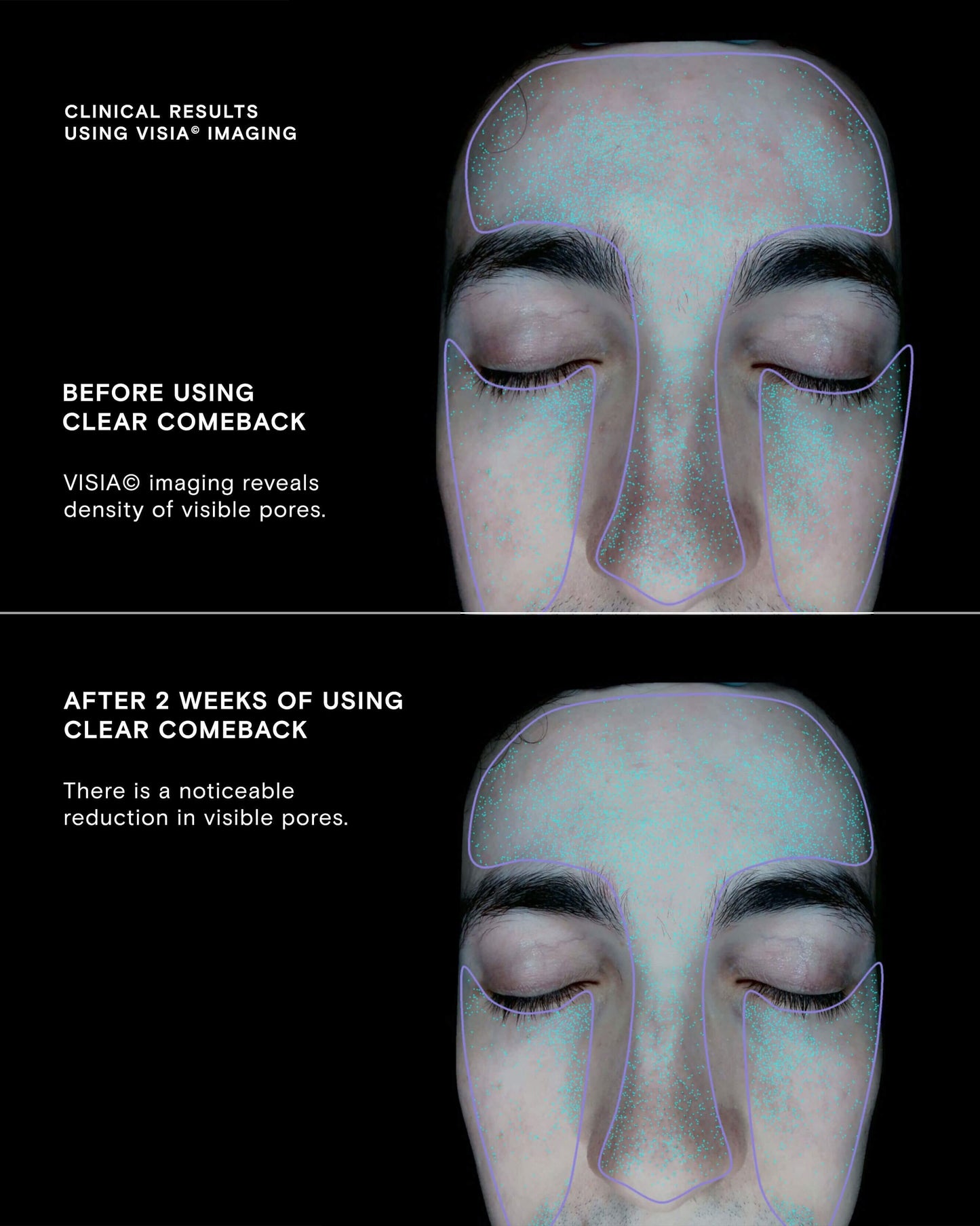 Clear Comeback Probiotic Enzyme Power Serum