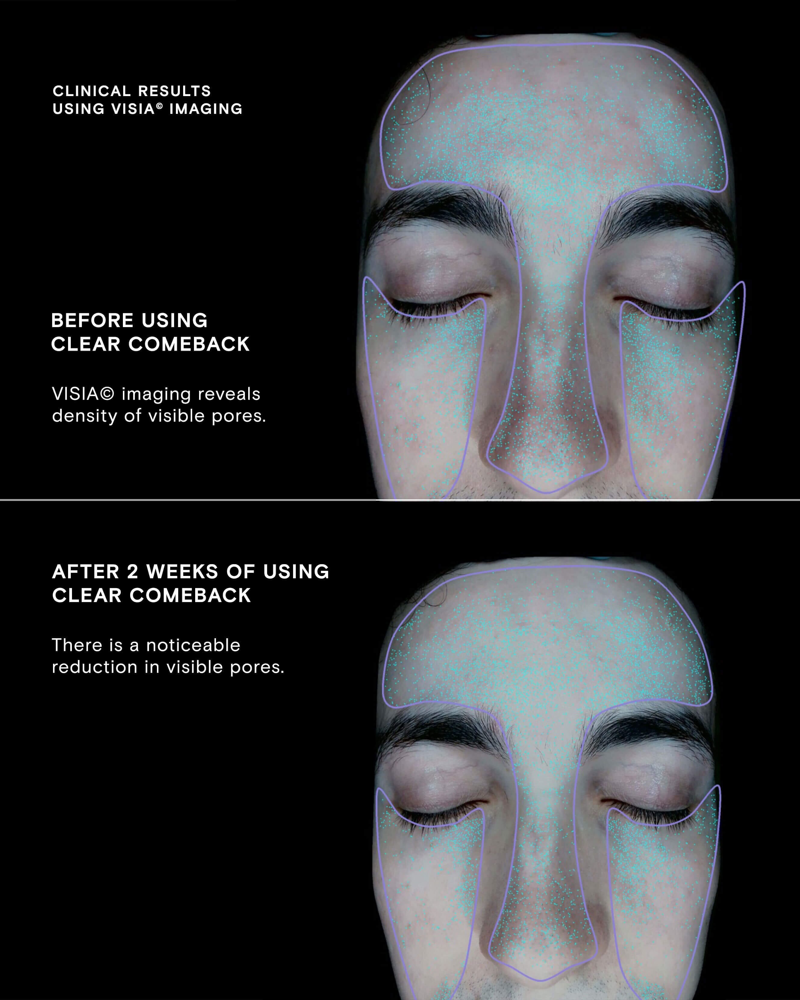 Clear Comeback Probiotic Enzyme Powder Refill