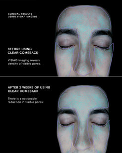 Clear Comeback Probiotic Enzyme Powder Refill