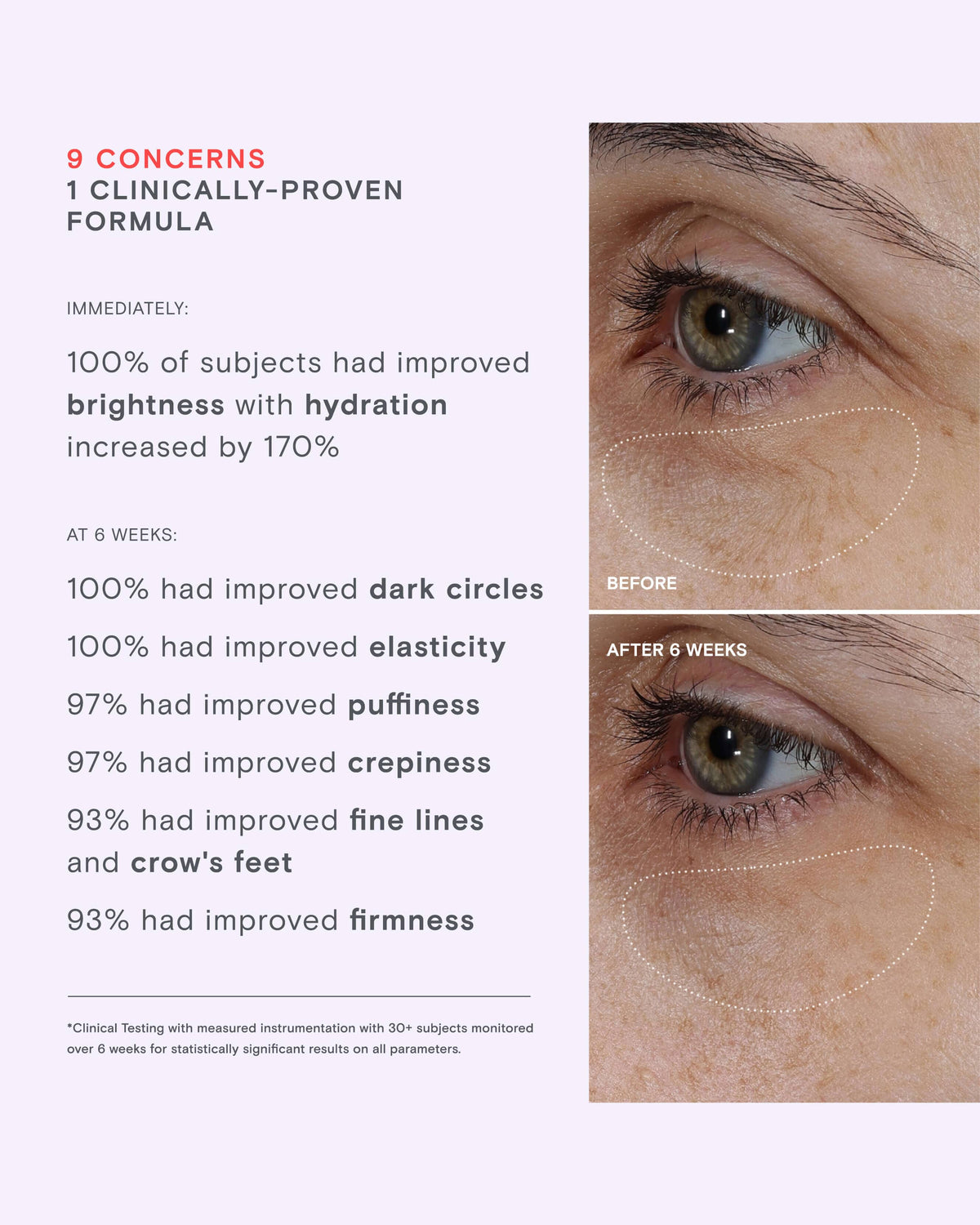 Needle Free Lifting Eye Cream