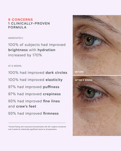 Needle Free Lifting Eye Cream