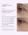 Needle Free Lifting Eye Cream