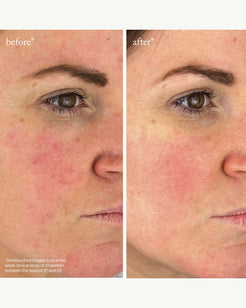Youth-Boost Peptide Serum