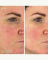 Youth-Boost Peptide Serum