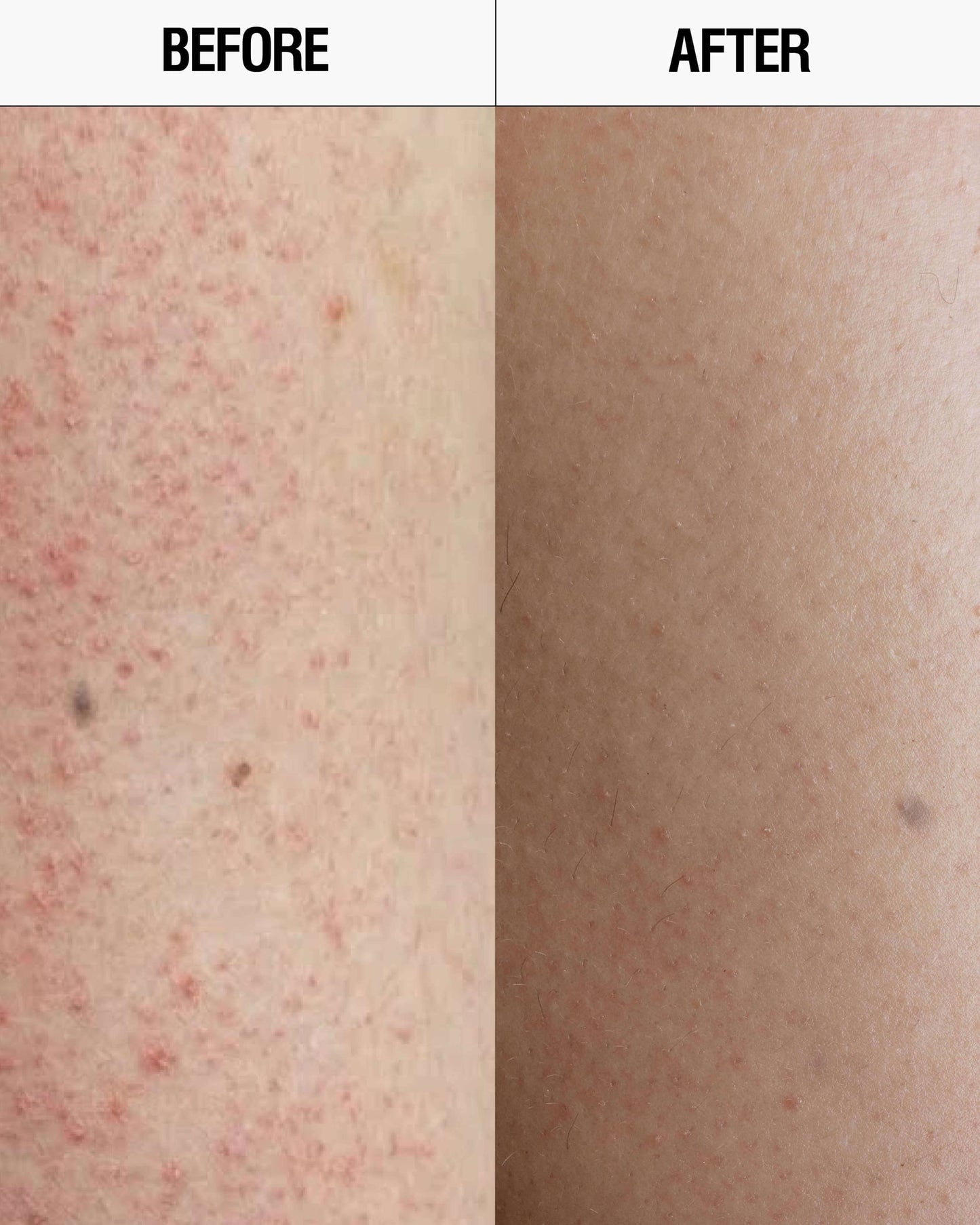 Resurfacing Targeted Body Cleanser