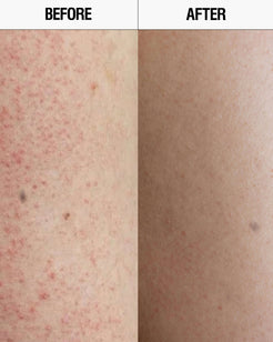 Resurfacing Targeted Body Cleanser