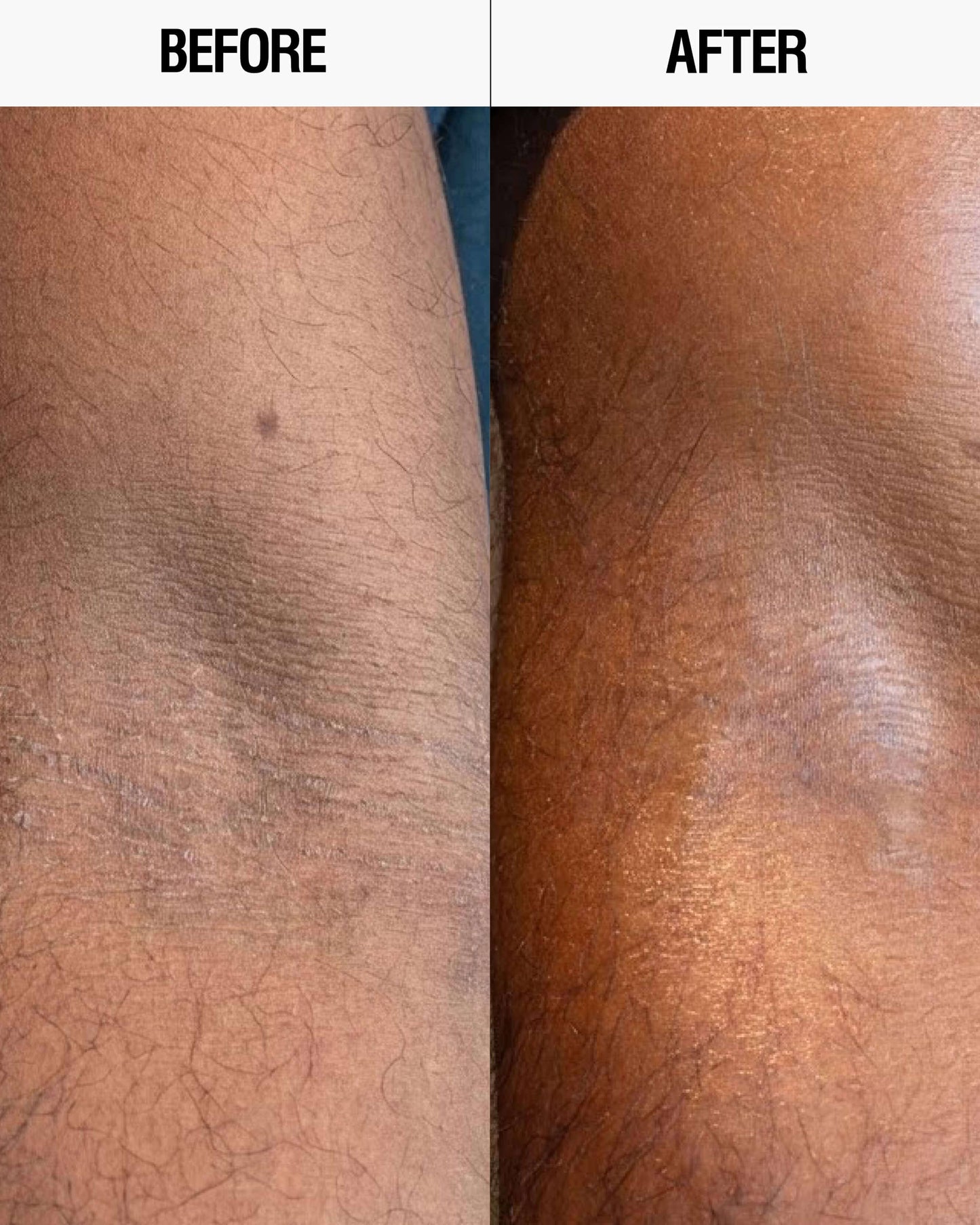 Resurfacing Targeted Body Lotion
