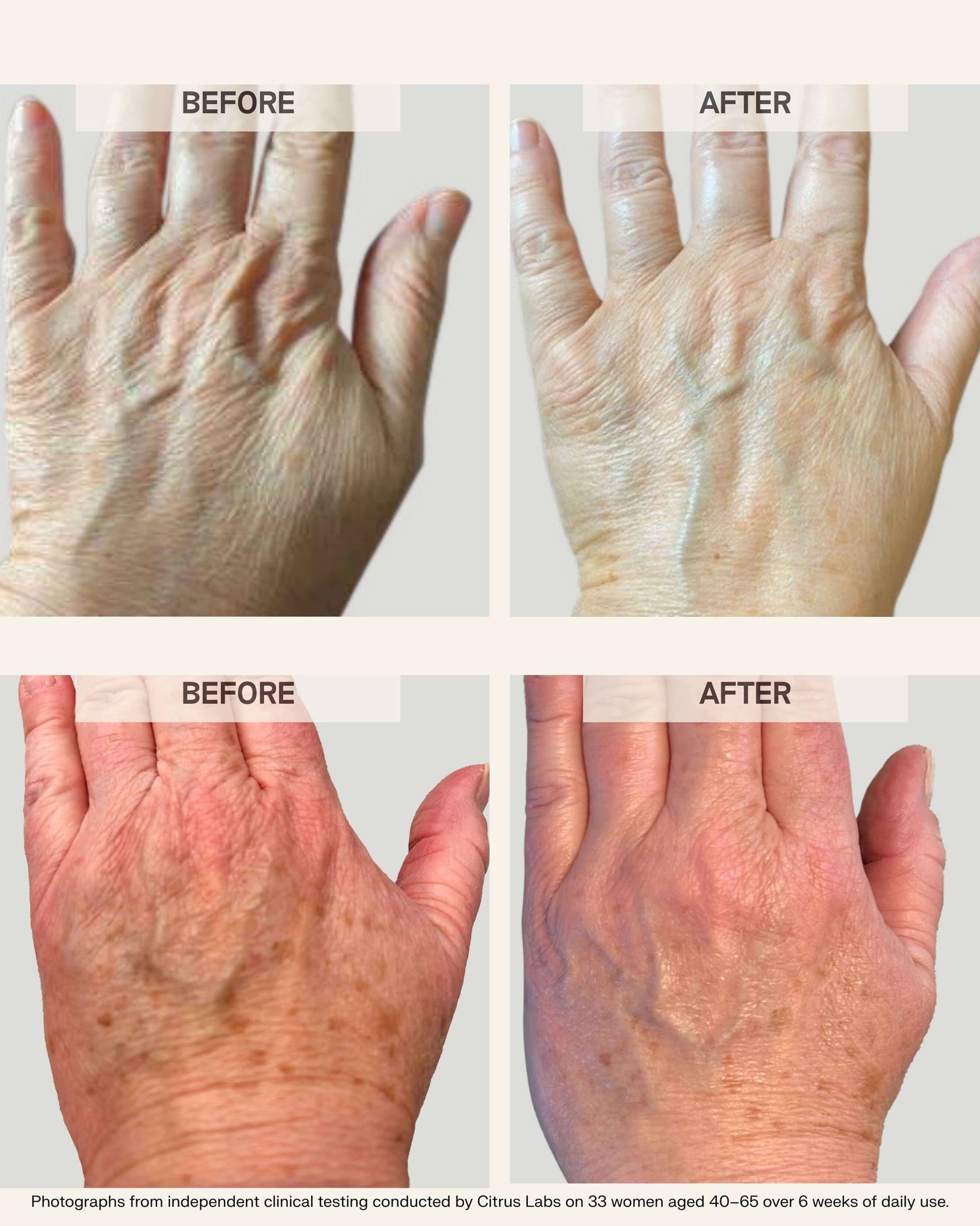 Activating Hand Serum