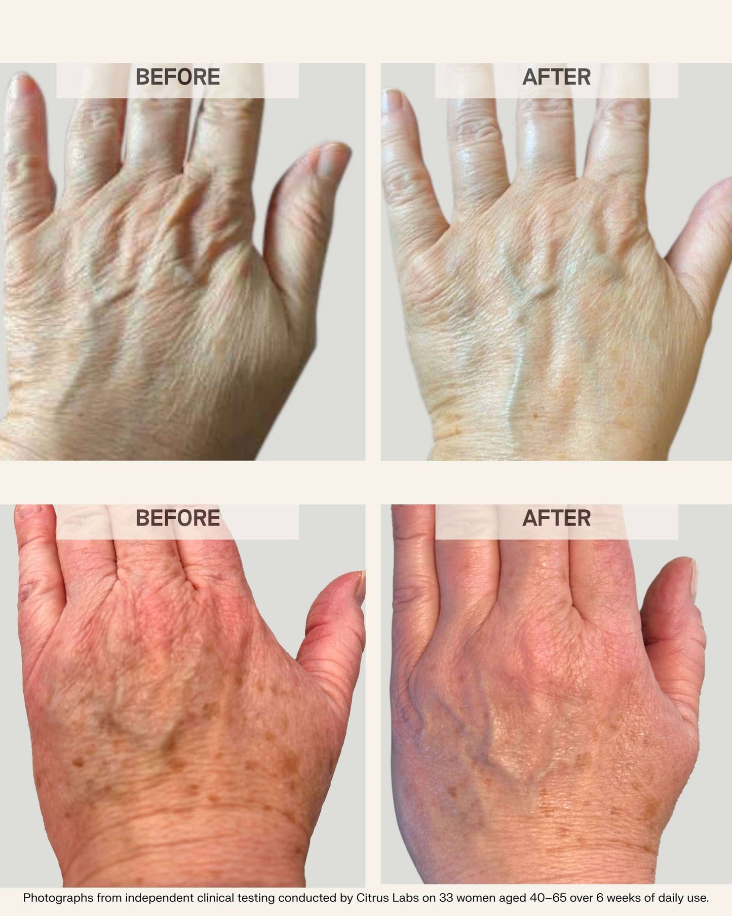 Activating Hand Serum