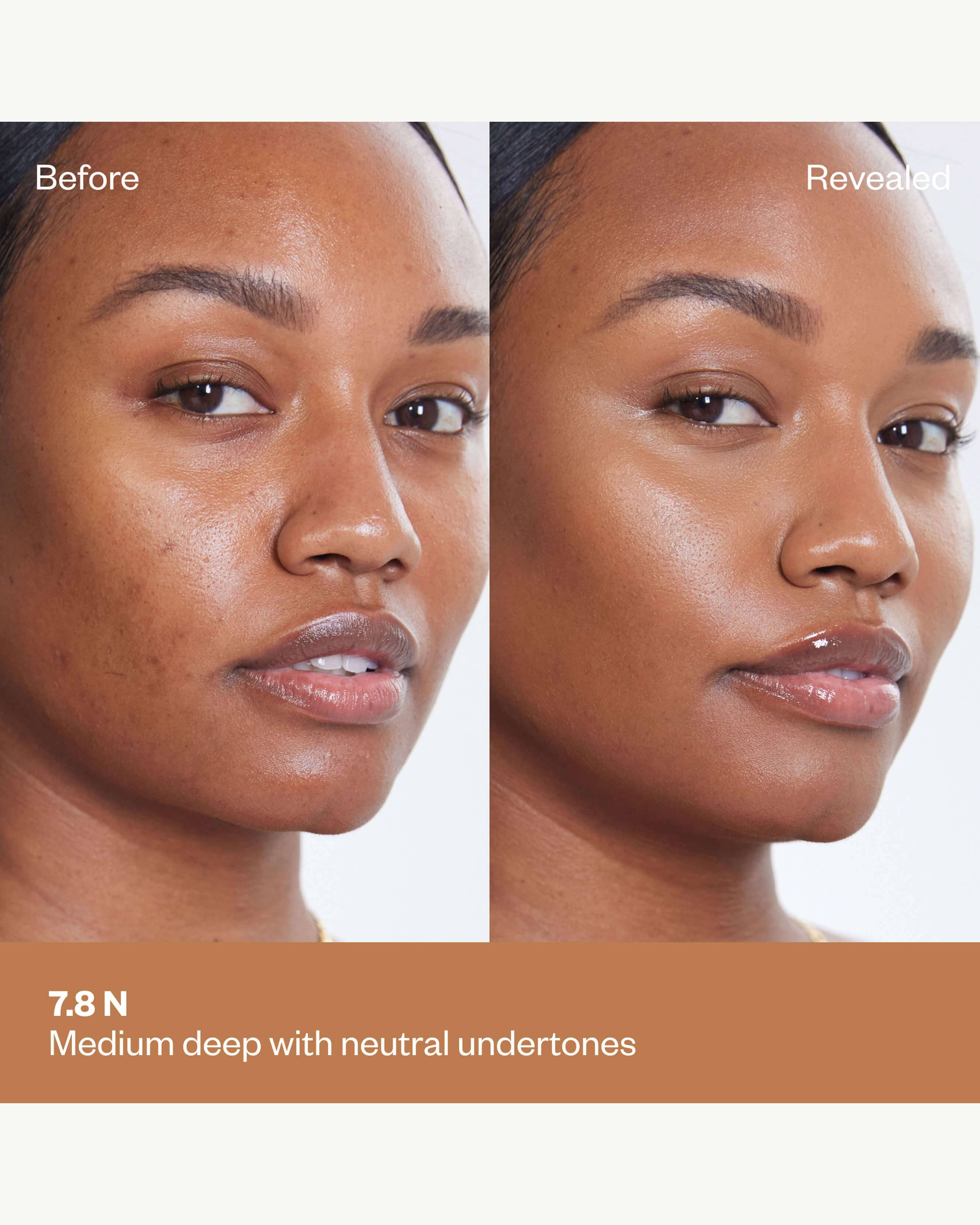 Tone 7.8 N (medium deep with neutral undertones)