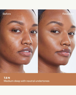 Tone 7.8 N (medium deep with neutral undertones)