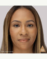TG5 (golden beige)