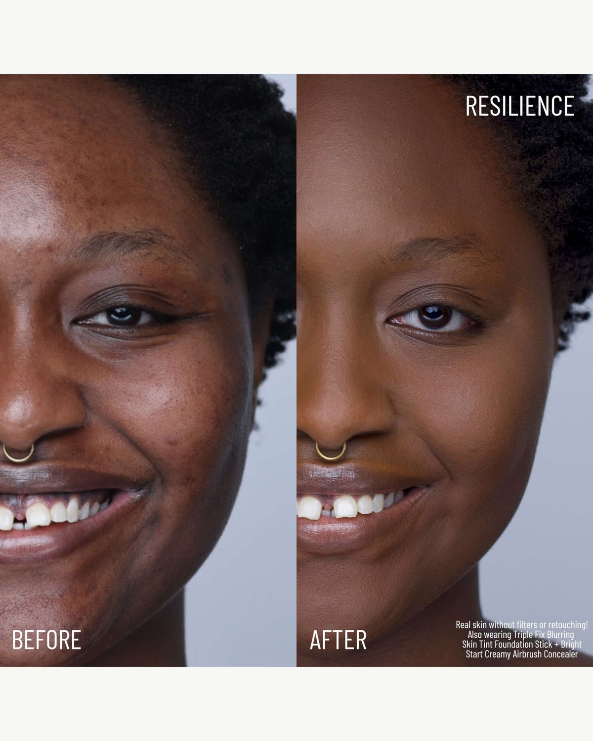 Resilience (translucent)
