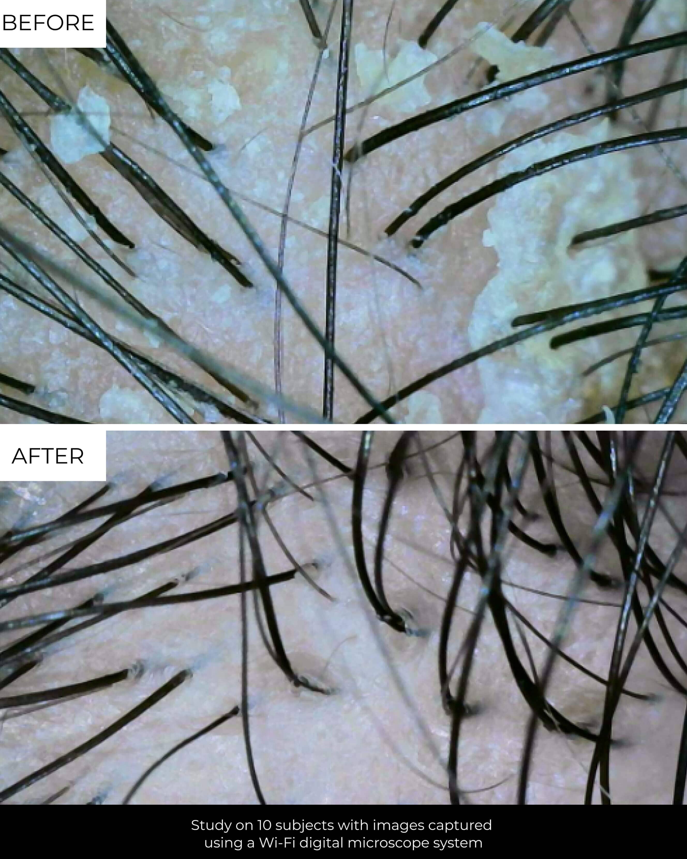 Exfoliate & Detox Scalp Shampoo