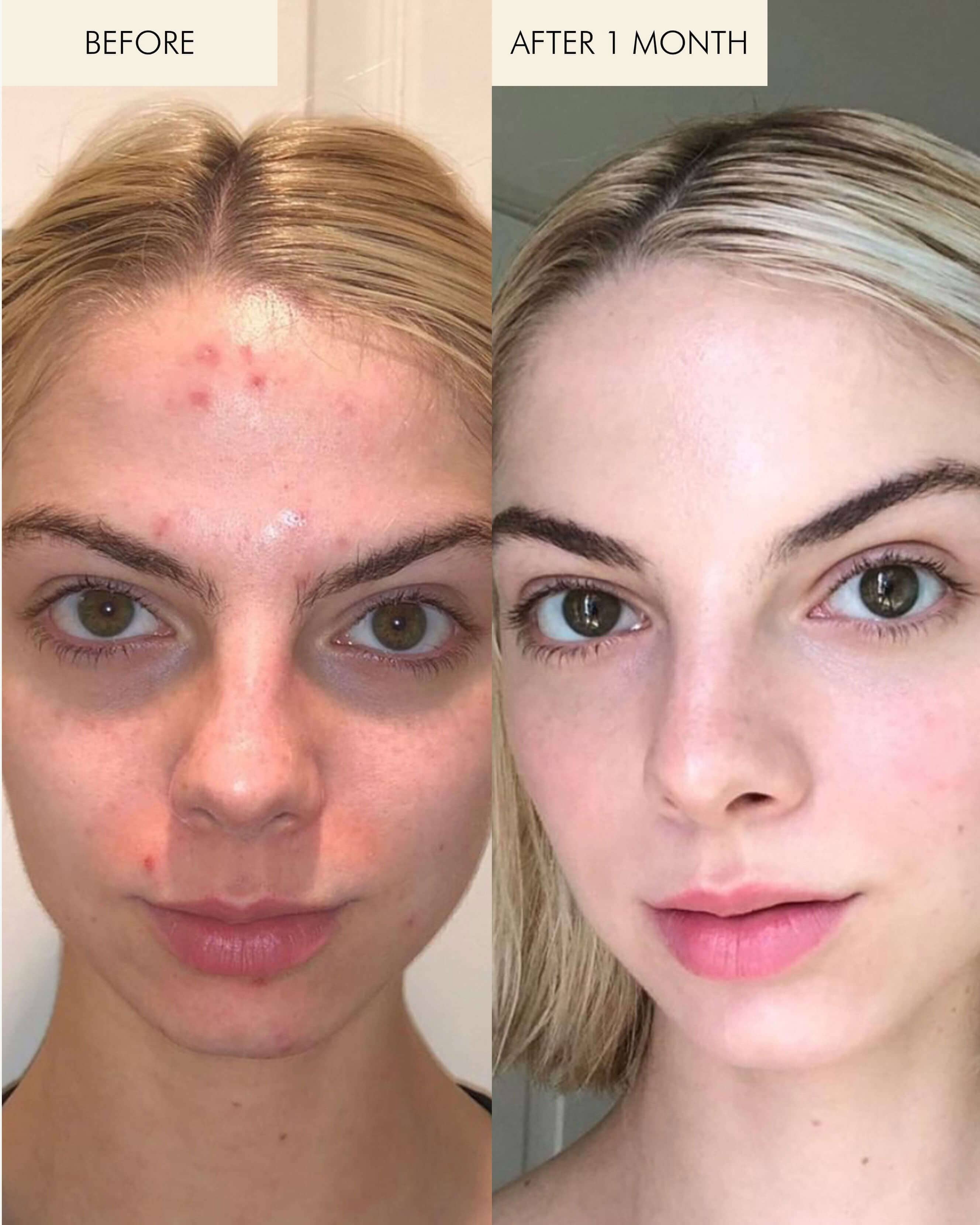 Primrose Face Engine Evening Primrose Oil And Skin