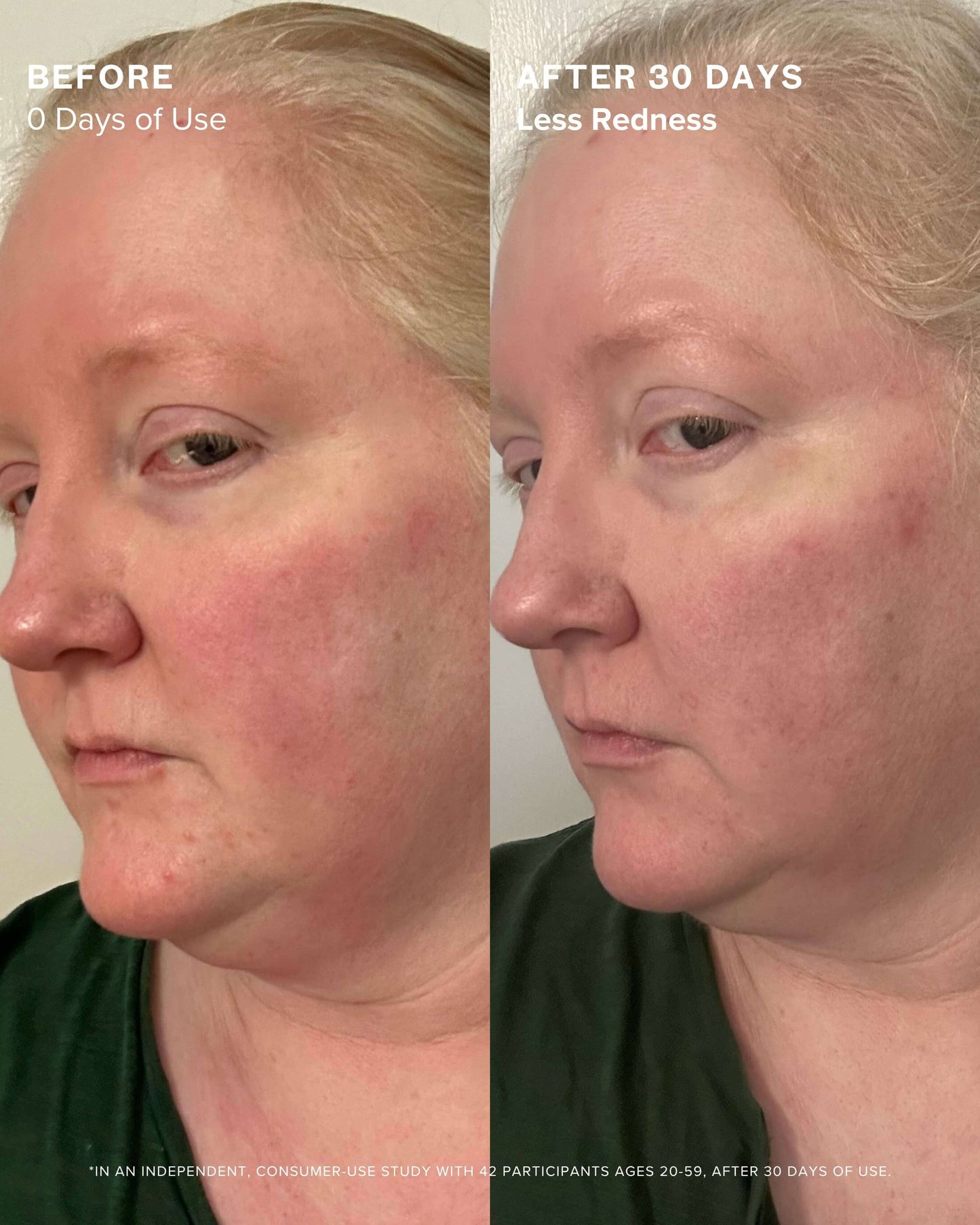 Clear Skin Mineral Milk 2% Salicylic Acid Acne Treatment with Niacinamide + Copper