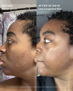 Clear Skin Mineral Milk 2% Salicylic Acid Acne Treatment with Niacinamide + Copper